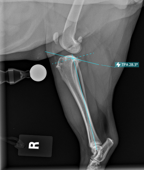 TPA Radiograph