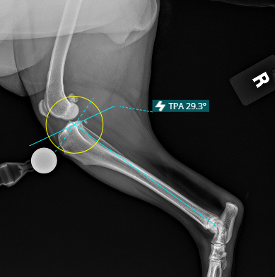 Tibial Plateau Angle