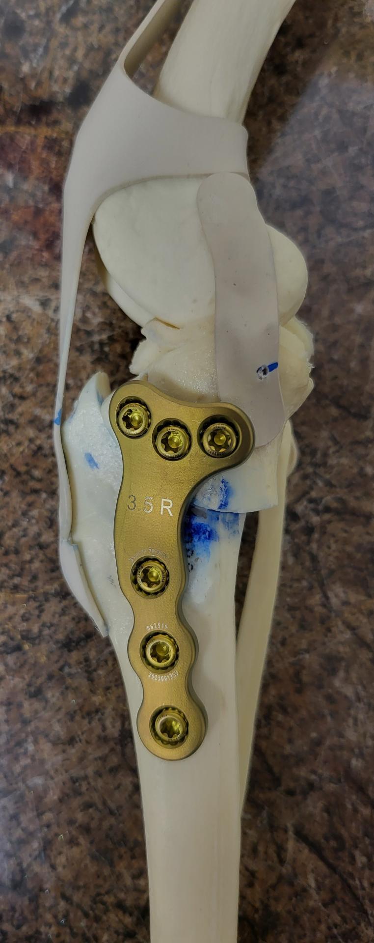 TPLO Dog Implant